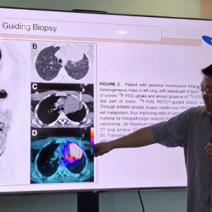 dr. Lim Andreas, SpKNTM, Subsp. Onk. (K), FANM memberikan keterrangan